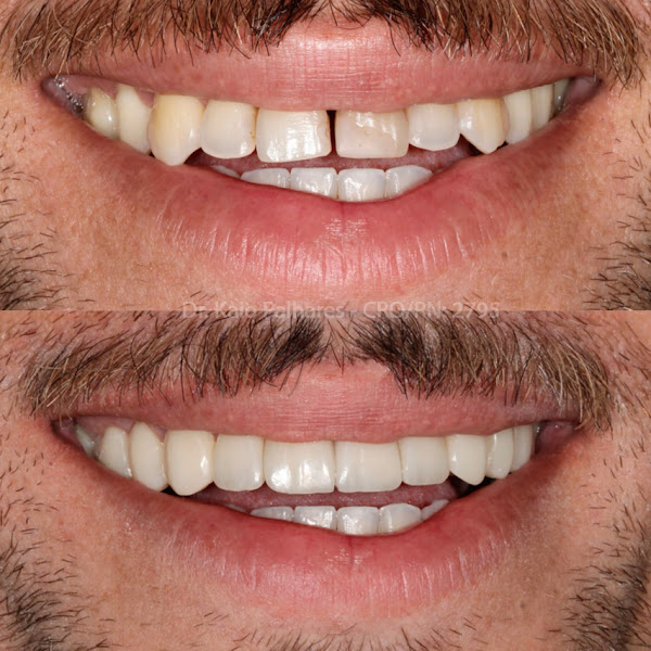 Foto 3 de Odonto Vitta - Clínica Odontológica em Natal/RN