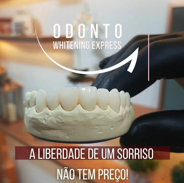 Foto 3 de Odonto Whitening