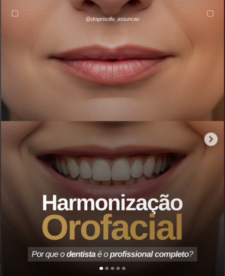 Foto 3 de OdontoArtDesign | Facetas no Batel