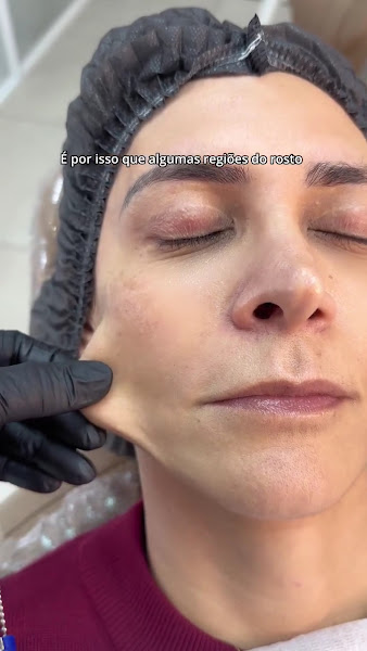 Foto 4 de OdontoArtDesign | Facetas no Batel