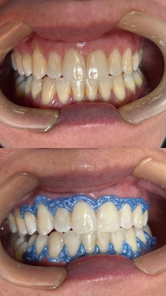 Foto 4 de OdontoArte