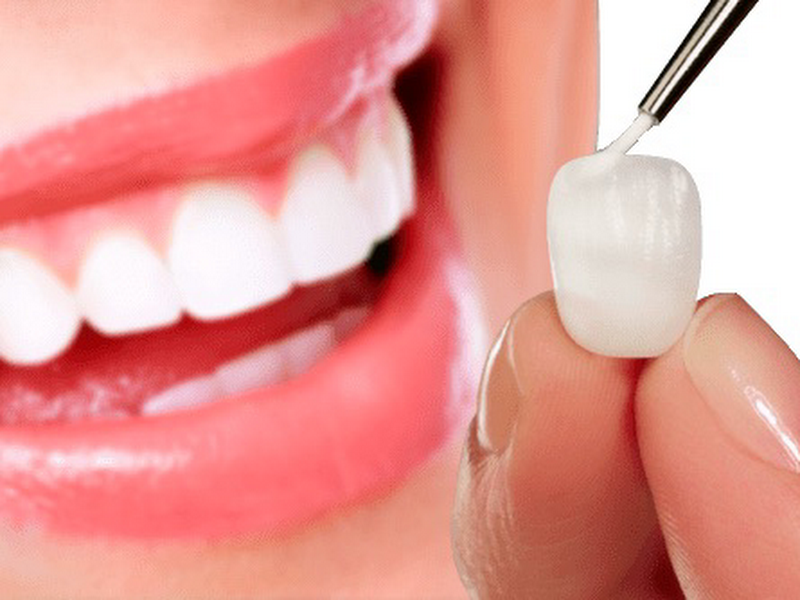 Foto 8 de OdontoBelle | Clínica Odontologica em Caxias | Especialistas em Próteses e Implantes Dentários