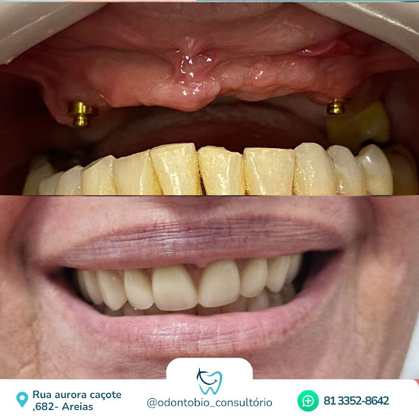 Foto 3 de OdontoBio Consultório Odontológico