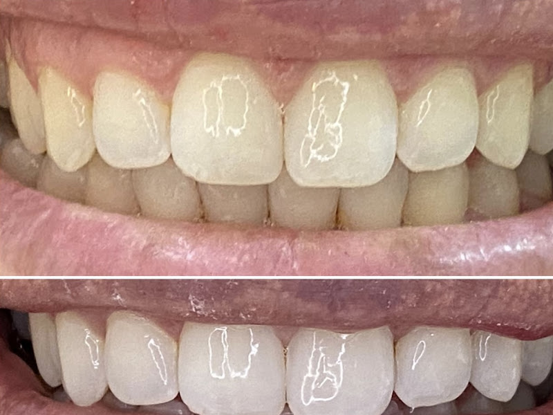 Foto 3 de Odontobliss