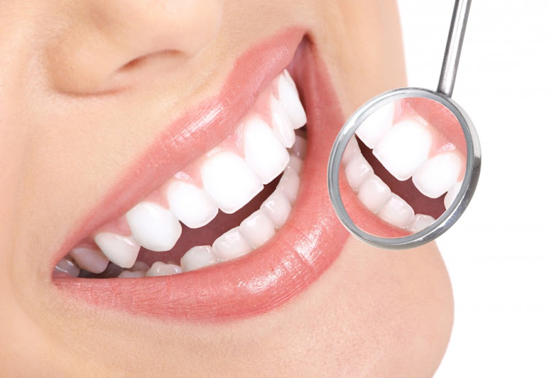 Foto 2 de Odontocabo