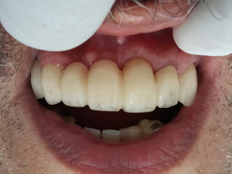 Foto 3 de ODONTOCAM - Senador Camará | Dentistas Especializados