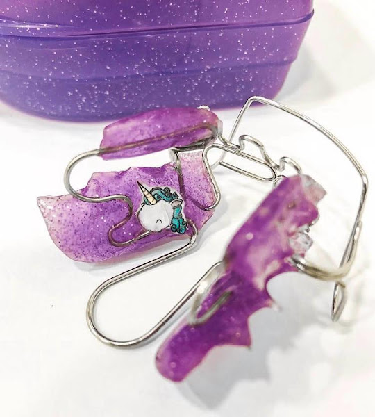 Foto 3 de OdontoCenter Lavras | Dentista Lavras | Ortodontia | Alinhador Invisível | Aparelho Fixo | SouSmile | Lavras