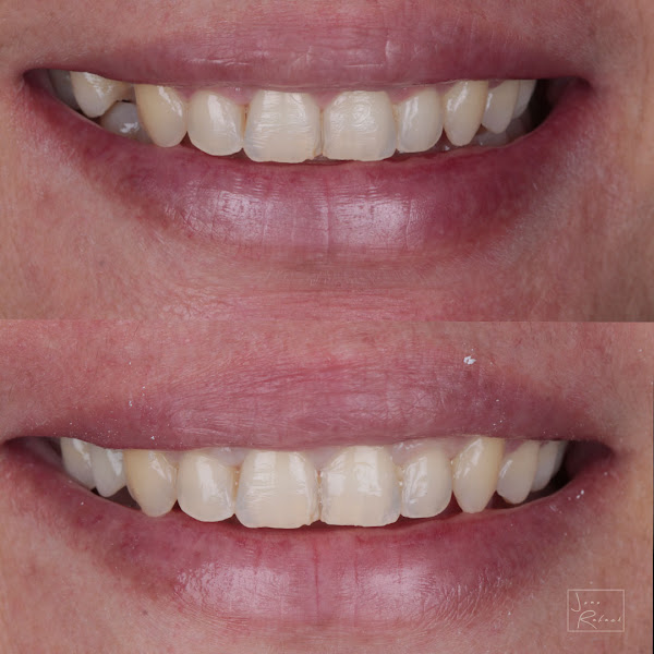 Foto de odontoclear