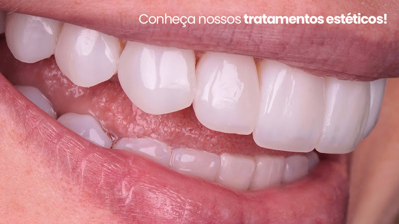 Foto 2 de OdontoClin