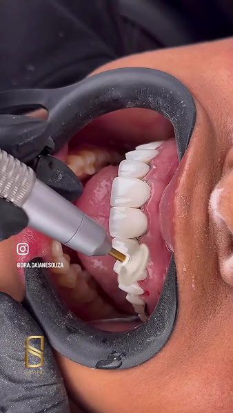 Foto 4 de OdontoClin