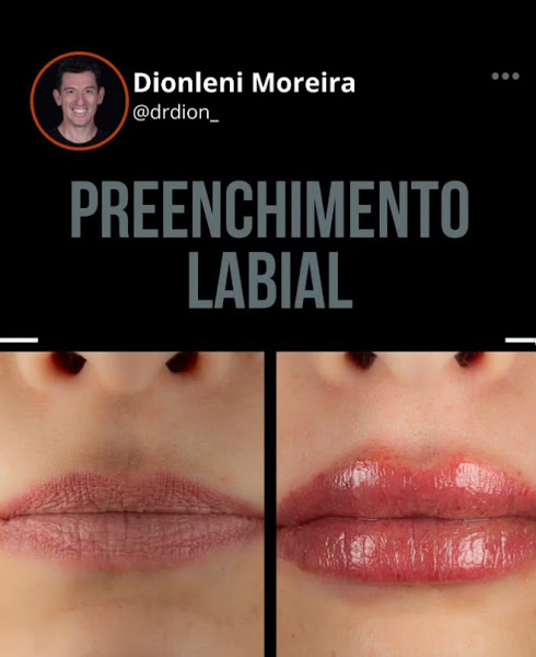 Foto 3 de Odontoclin - Clinica Odontologica em Marabá