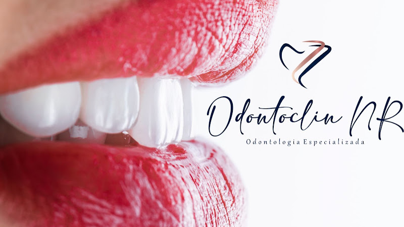 Foto 2 de OdontoClin NR – Dentista em Guarulhos Especialista Facetas de Resina