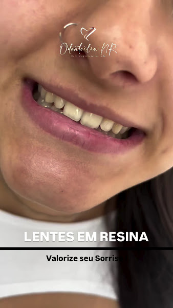 Foto 3 de OdontoClin NR – Dentista em Guarulhos Especialista Facetas de Resina