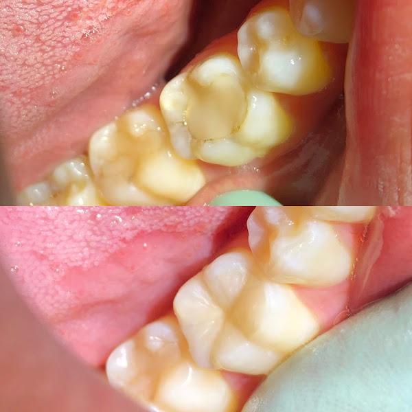 Foto 2 de OdontoClin tga