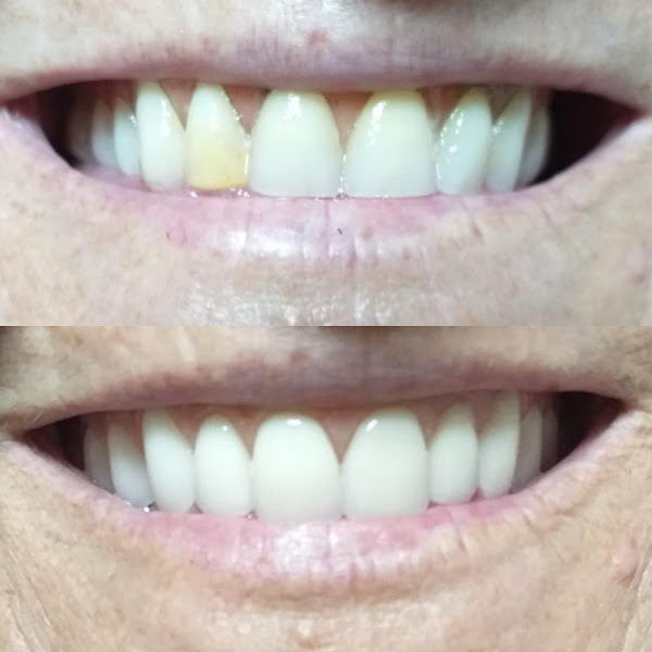 Foto 3 de OdontoClin tga