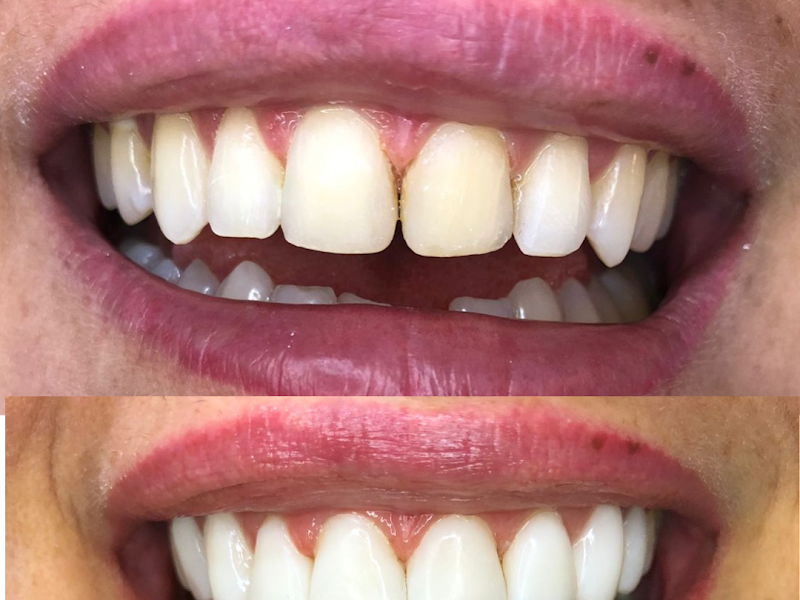 Foto 7 de Odontoclinic - Campo Grande Cel. Antonino