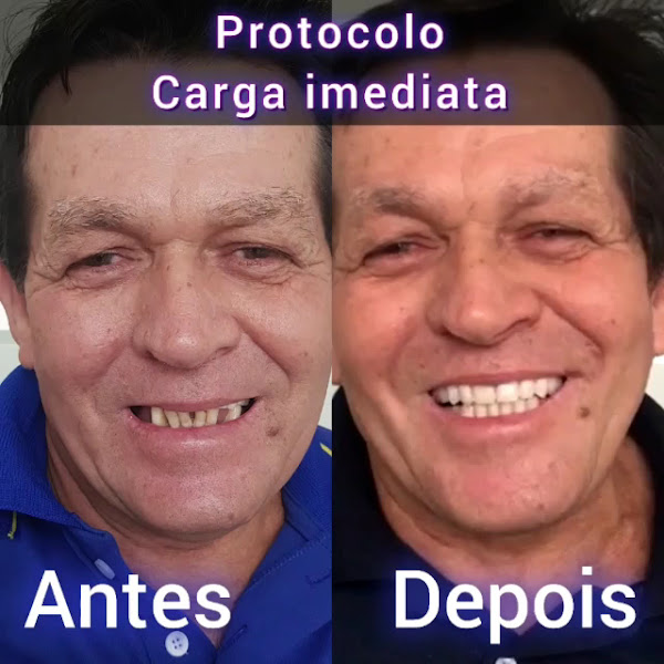 Foto 3 de Odontoclinic - Dentista em Santa Bárbara d'Oeste - SP - Implante, Protese Protocolo, Aparelho, Ortodontia, Odontologia