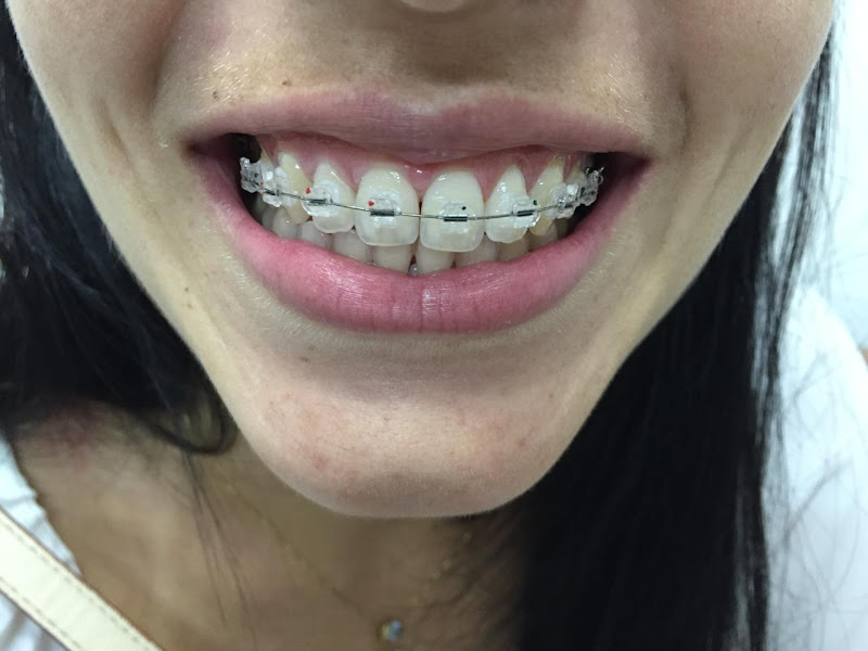 Foto 3 de Odontoclinic Londrina