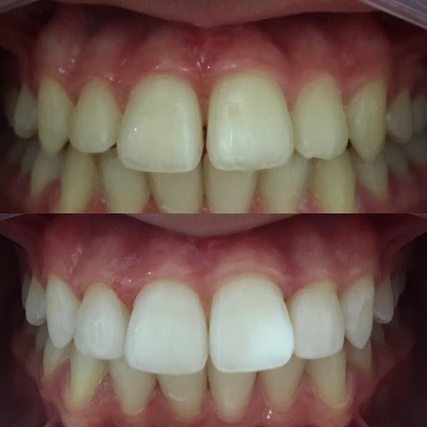 Foto 2 de ODONTOCLÍNICA