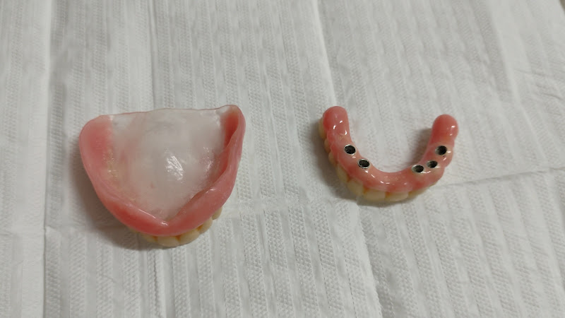 Foto 4 de Odontoclínica P Norte - Implantes em Ceilândia - Prótese Dentária em Ceilândia
