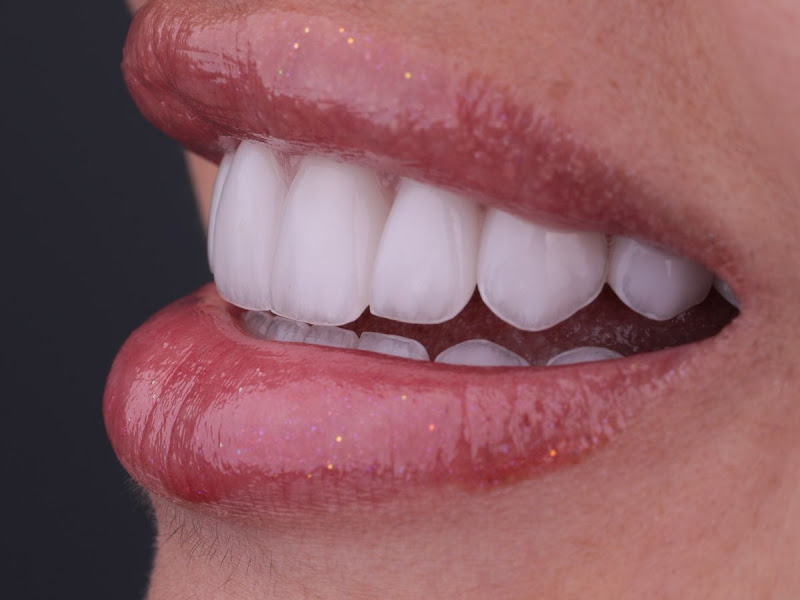 Foto 2 de OdontoCompany