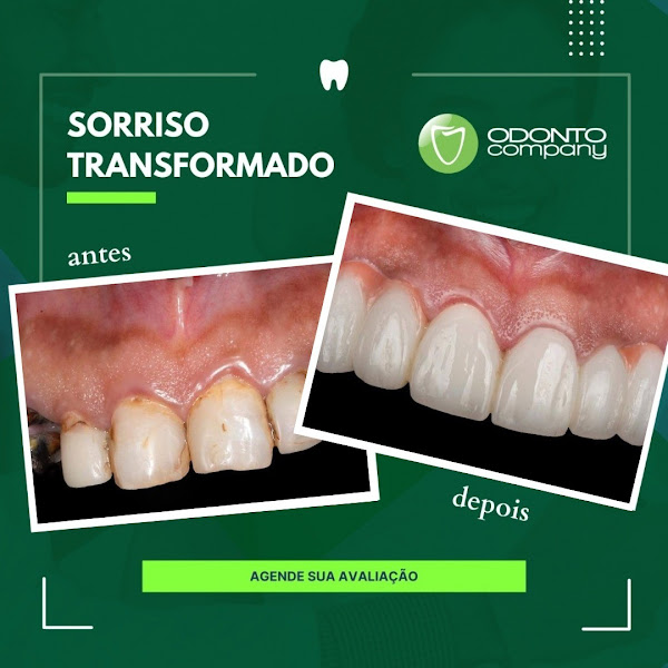 Foto 3 de OdontoCompany Barroca-BH