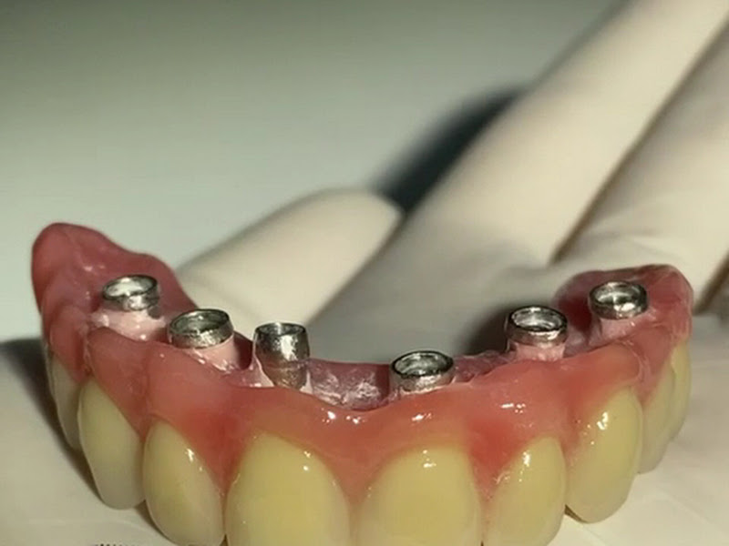 Foto 11 de OdontoCompany Cabo Branco