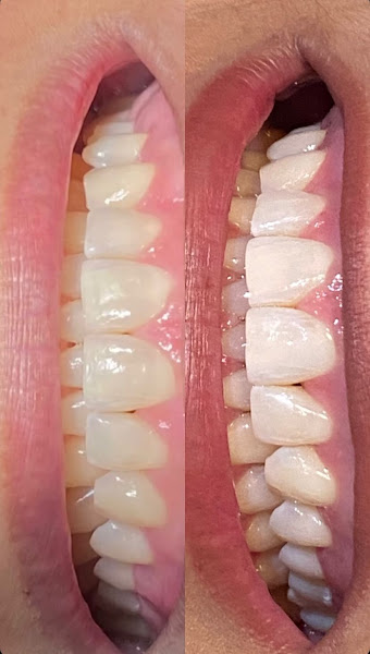 Foto 3 de OdontoCompany Cariri