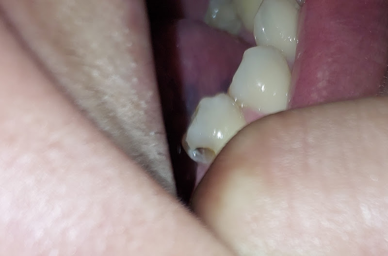 Foto 3 de OdontoCompany Cidade Tiradentes