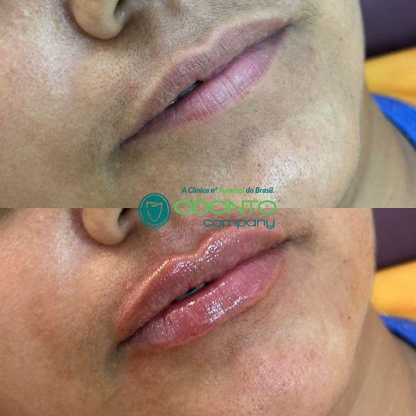 Foto 3 de OdontoCompany Geisel - Clínica Odontológica - Próteses - Implantes - Ortodontia - Dentistas