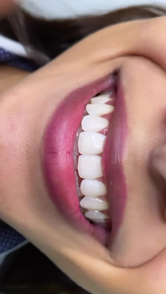 Foto 4 de OdontoCompany Geisel - Clínica Odontológica - Próteses - Implantes - Ortodontia - Dentistas