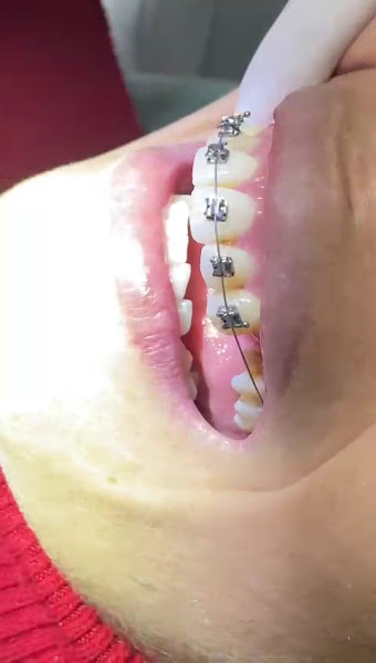 Foto 5 de OdontoCompany Geisel - Clínica Odontológica - Próteses - Implantes - Ortodontia - Dentistas