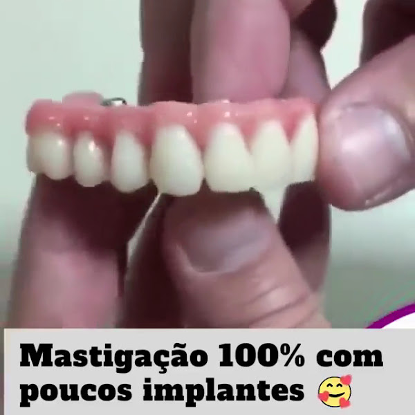 Foto 3 de OdontoCompany Implante Dentário Recanto do Sol Anapolis