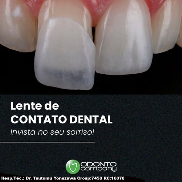Foto 5 de Odontocompany SBC-Centro Dentista-Implantes-Protocolo-Próteses-Aparelho-Facetas-Canal-Harmonização-Cirurgias-Clinico Geral