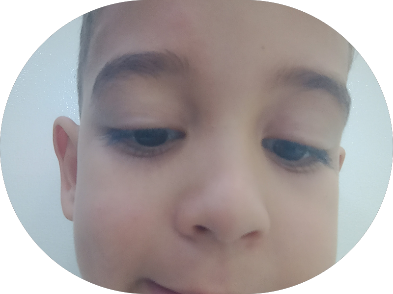 Foto 7 de Odontocompany SBC-Centro Dentista-Implantes-Protocolo-Próteses-Aparelho-Facetas-Canal-Harmonização-Cirurgias-Clinico Geral