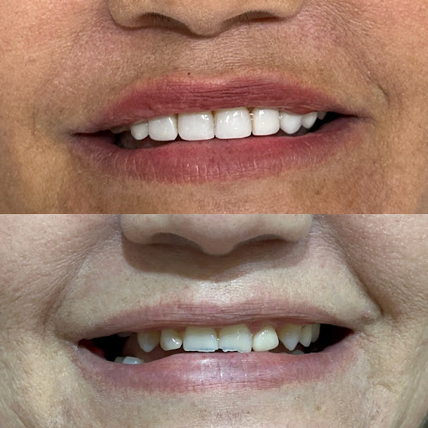 Foto 4 de OdontoDentine