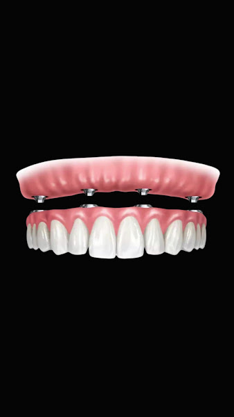 Foto 5 de OdontoDentine