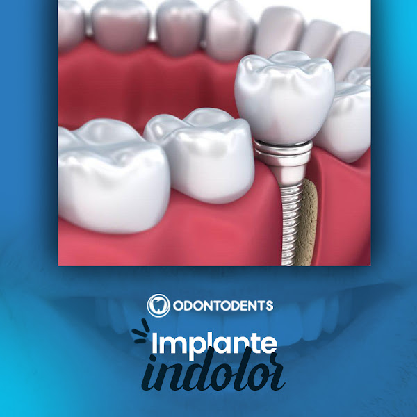 Foto 3 de Odontodents