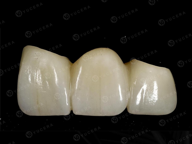 Foto 7 de Odontoelis