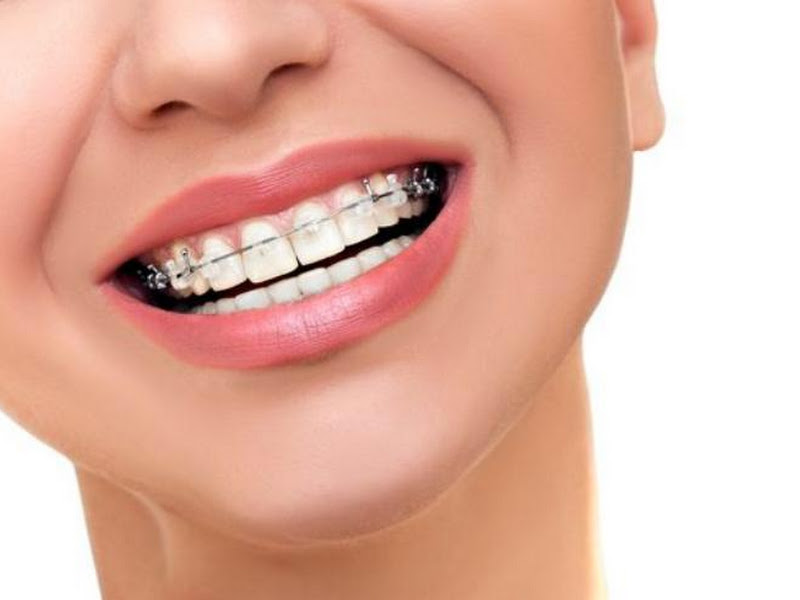 Foto 3 de OdontoEmery