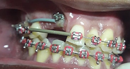 Foto 3 de Odontoestética Delzira Silva