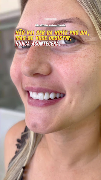 Foto 3 de Odontoestima