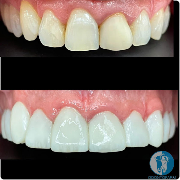 Foto 3 de ODONTOFARM - Dentistas