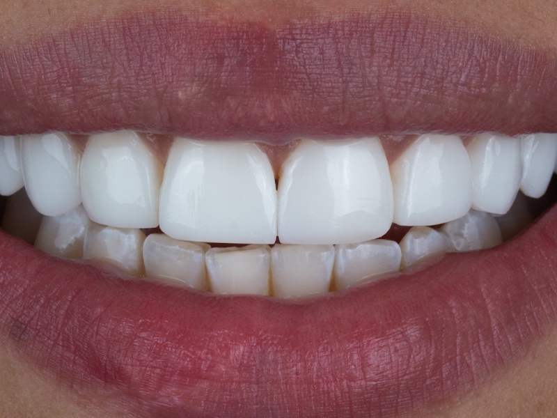 Foto 2 de Odontofor Clínica Odontologica