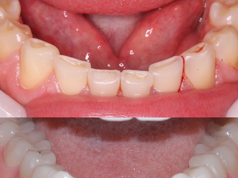 Foto 10 de OdontoGalerie - Clínica Odontológica e de Harmonização Facial em João Pessoa