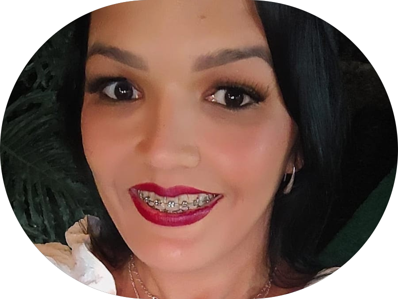 Foto 4 de Odontoglaze