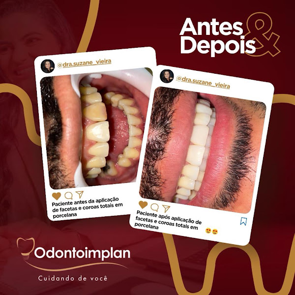 Foto 2 de Odontoimplan