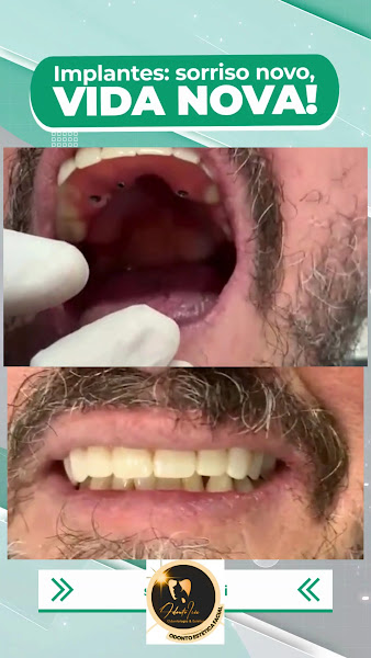 Foto 4 de ODONTOIRIS CONSULTÓRIO ODONTOLOGICO