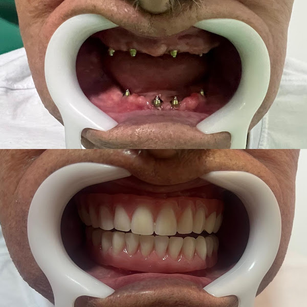 Foto de Odontokingzaira