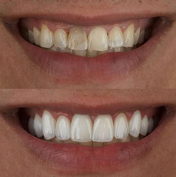 Foto 2 de OdontoLab Digital